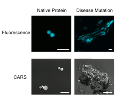 Ursprüngliche und krankhaft veränderte RNP granulare Proteine. Messbalken 20 µm.