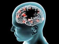 Das internationale Forscherteam arbeitet an einem Behandlungsansatz für die Alzheimer-Krankheit, die zum Absterben von Nervenzellen im Gehirn führt.
